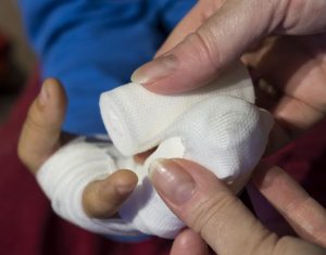 child, boy, injury, injured, association, bandages, pavement, finger, hand, doctor, nurse, hospital, pain, pains, first aid, injury, injury, injury, first aid, first aid, first aid, first aid, first aid